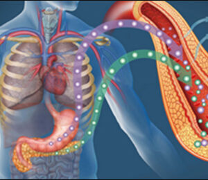 Dinh dưỡng đối với Rối loạn chuyển hoá